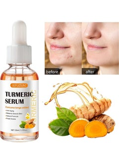 Buy Turmeric Dark Spot Serum 30ml, Dark Spot Correcting Serum for Face and Body, Reduces Hyperpigmentation, Age Spots, Sun Spots and Improves Skin Tone for Women and Men of All Skin Types in Saudi Arabia