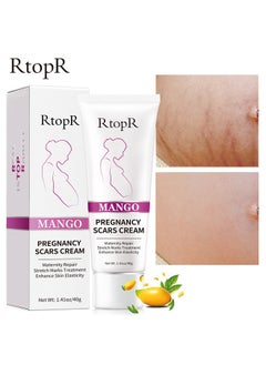 Buy Mango Stretch Mark Cream, For Maternity Repair Stretch Marks Enhance Skin Elasticity, Can Promote Cell Regeneration, Repair Necrotic Cells, Designed For Mother's Stretch Marks in UAE