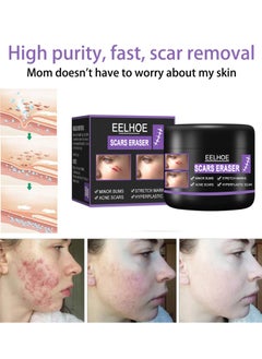 Buy Scar Erase ，Scar Removal Gel，Scar Removal Cream，Acne Scar Treatment，Deep Acne Scar Removal，Burns Keloids Hypertrophic，Repair Damaged Skin，Removing Acne Marks Scar Repair Cream ﻿，Stretchmarks Cream ﻿ in Saudi Arabia