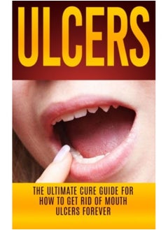 اشتري Ulcers The Ultimate Cure Guide For How To Get Rid Of Mouth Ulcers Instantly في الامارات