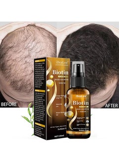 Buy Biotin Hair Growth Spray, Hair Regrowth Spray, Biotin Thickening Herbal Serum, Anti Hair Loss Serum For Hair Growth And Hair Loss, Hair Regrowth For Thicker Longer Fuller Hair in Saudi Arabia