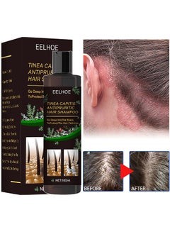 Buy Tinea Capitis Antipruritic Hair Shampoo, Anti-Dandruff Shampoo, Shampoo For Scalp Prone To Folliculitis, Dermatitis, Dandruff, Mites, Itchy And Flaky Scalp, Treats Dandruff And Seborrheic Dermatitis in UAE