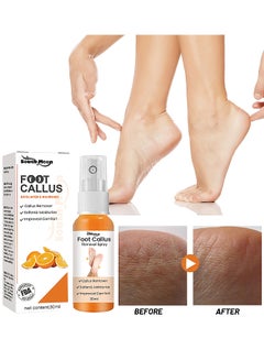 Buy Anti Foot Callus Removal Spray - Foot Callus Removal Spray - Instant Foot Peeling Spray - Foot Peeling Spray Oil - Foot Peeling Spray For Remove Dead Skin in UAE