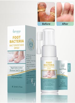 Buy Shoe Deodorizer Foot Spray Odor Smell Eliminator Freshener for Athlete Sweat Feet Skin Repair in Saudi Arabia