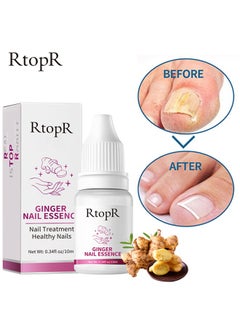 Buy Ginger Nail Essence - Has Antifungal And Antibacterial Properties, Relieves Nail Infections, And Promotes Nail Healing, Nail Treatment Healthy Nails Repair Essence 10ml in UAE