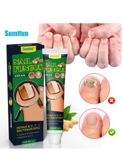 Buy 30g Nail Toe Cream, Nail Repair Cream, Nail Cream Anti Harmful Substances Repair Finger Toe Nail Care Perfect for Men and Women Home Use in Saudi Arabia