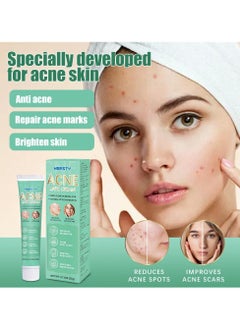 Buy Acne Treatment Face Cream, Acne Spot Treatment for Face & Acne Dots, Natural Cystic Acne Treatment ，Premium Acne Scar Cream & Pimple Remover，Psoriasis Ointment Herbal ，Psoriasis Cream Eczema Cream. in Saudi Arabia