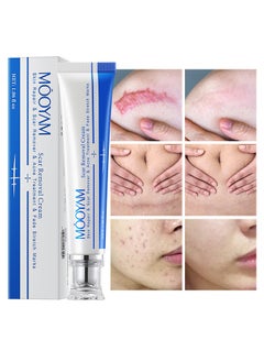 Buy Scar Removal Cream-Skin Repairing Cream Fade Scars/Stretch Marks/Acne Treatment, Improve Scar Skin, Deeply Moisturizes Skin-30ml in UAE