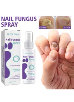 Buy 100ml Effective Anti-Fungal Feet Infections Athlete Foot Nail Fungus Hand And Foot Care Treatment Spray Beauty Health Care in UAE