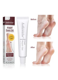 Buy Foot Repair Gel，Repair Dry Cracks Foot Repair Cream for Repairing Dry Cracks Heel Foot Exfoliates and Deeply Moisturizes Heel Balm for Feet Foot Cracked Repair Gel Cream Urea Cream for Feet 30g in UAE