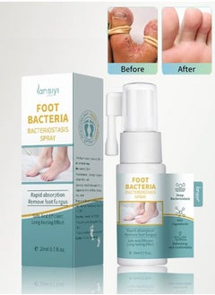 Buy Foot Bacteria Bacteriostasis Spray,Shoe Deodorizer Foot Spray Odor Smell Eliminator Freshener for Athlete Sweat Feet Skin Repair,Anti Fungal for Prevent Athlete's Foot,,Relieve Itching of Feet 20ml in Saudi Arabia