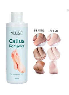 Buy Callus Remover For Smooth Soft Feet 250ml in Saudi Arabia