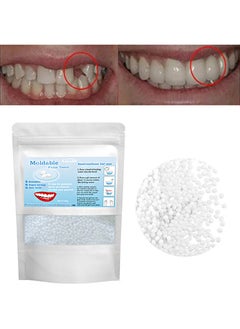 Buy 150g Moldable False Teeth Temporary tooth restoration beads, hot adhesive accessories, tooth filling materials, tooth restoration kits for missing and broken dentures in Saudi Arabia