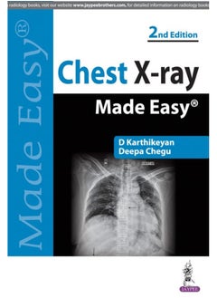 اشتري Chest Xray Made Easy By Karthikeyan, D. - Chegu, Deepa Paperback في الامارات