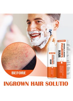 Buy Ingrown Hair Essence Brightening Skin  Get Rid of Beard Nursing Essential Oils,Repairing Serum to Reduce Dark Spots After Shaving Gentle on Ingrown Hair in Saudi Arabia