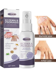 Buy Eczema And Psoriasis Atomizing Spray 30ML, Hand And Foot Moss Skin Repair, Relieve Itching, Skin Care And Jiejia Spray, Antibacterialnot Irritating Safety in Saudi Arabia