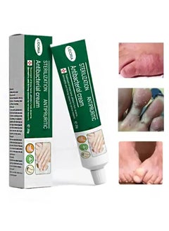 Buy Sterilization Antipruritic Antibacterial Cream for Hands and Feet, Safe, Natural, Fast Skin Care Topical Use, Restore Healthy Natural Skin in Saudi Arabia