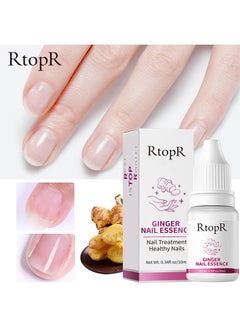 Buy Ginger Nail Repair Essence 10ml, Has Antifungal And Antibacterial Properties, Relieves Nail Infections, And Promotes Nail Healing, Nail Treatment Healthy Nails in Saudi Arabia