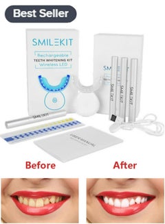 اشتري Teeth Whitening Kit, Suitable For Sensitive Teeth Gums Braces Care في الامارات