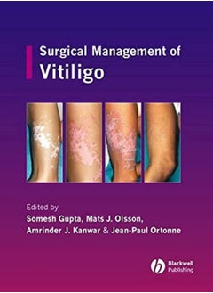 Buy Surgical Management of Vitiligo in UAE