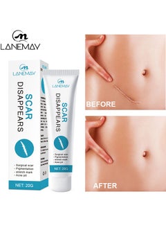 Buy Scar Cream, Medical Grade Silicone Scar Cream Advanced Scar Removal Gel For Surgical Scars Stretch Marks Acne Injury Burns Keloids Hypertrophic Old And New Scars 20G in Saudi Arabia