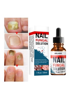 Buy Nail Repair Solution Onychomycosis Care in Saudi Arabia