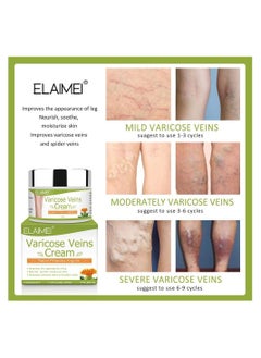 اشتري Varicose Vein Cream 50g Varicose Vein Cream Anti-spider Veins And Spider Vein Removal في الامارات