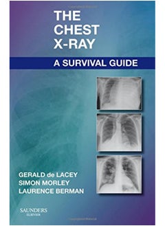 اشتري The Chest Xray A Survival Guide By de Lacey, Gerald, MA, FRCR (Consultant Radiologist to and formerly Consult Paperback في الامارات