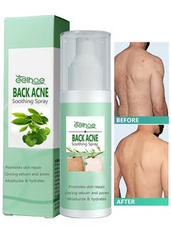 Buy 120ML Back Acne Treatment Soothing Spay, Back Acne Spray, Niacinamide Spray, Body Acne Treatment with Herbal Formula, Tea Tree Oil Spray, Body Acne Treatment Spray For Teens, Gentle On Skin in Saudi Arabia