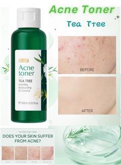 Buy 100ml Tea Tree Acne Toner Acnes Oil Control Face Toner ，Tea Tree  Anti Acne  Refreshing Moisturizing and Softening Toner in Saudi Arabia