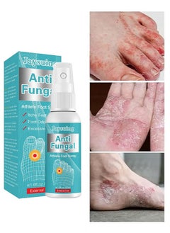 Buy Anti Fungal Athletes Foot Spray-Anti Fungi Treatment For Feet Itchy, Sweating, Peeling And Blisters, Natural Ingredients Foot Fungi Spray For Tinea Pedis 50ML in UAE