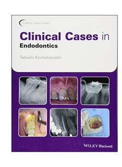 اشتري Clinical Cases In Endodontics Paperback في الامارات