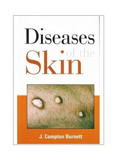 اشتري Diseases Of The Skin paperback english - 30 Jun 2001 في السعودية