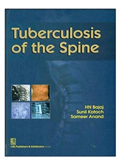 اشتري Tuberculosis Of The Spine Hardcover في مصر