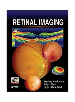 Buy Retinal Imaging Paperback English by Pradeep Venkatesh - 30 Dec 2008 in Egypt