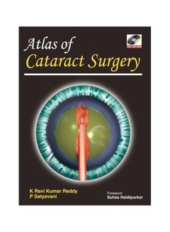 Buy Atlas Of Cataract Surgery hardcover english - 24 Jul 2009 in Egypt