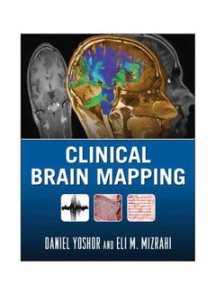 اشتري Clinical Brain Mapping hardcover english - 08 Jul 2012 في مصر