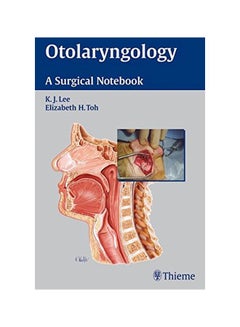 اشتري Otolaryngology : A Surgical Notebook Paperback في مصر