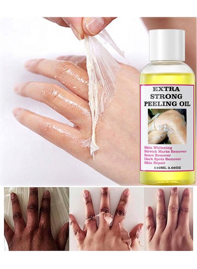 Buy Yellow Peeling Oil 110ml Super Strength Dead Skin Remover Skin Moisturizing Hydrating Butter Peeling Remove Dead Skin and Calluses on Feet and Hand Dark Spot Peeling Oil in UAE