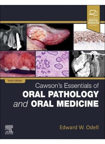 اشتري Cawsons Essentials Of Oral Pathology And Oral Medicine في الامارات