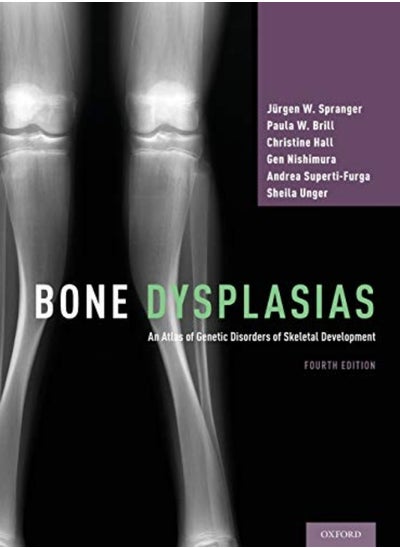 Buy Bone Dysplasias An Atlas Of Genetic Disorders Of Skeletal Development by Spranger, Jurgen W. (Professor Emeritus of Pediatrics, Professor Emeritus of Pediatrics, University Hardcover in UAE