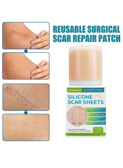 Buy Fade Scar Sticker Efficient Beauty Scars Removal in Saudi Arabia