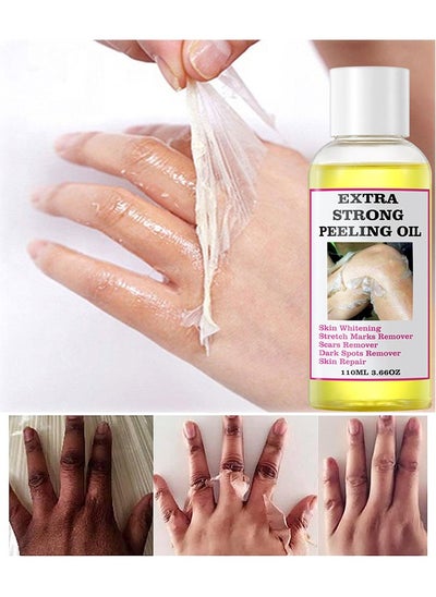 Buy Yellow Peeling Oil 110ml Super Strength Dead Skin Remover Skin Moisturizing Hydrating Butter Peeling Remove Dead Skin and Calluses on Feet and Hand Dark Spot Peeling Oil in UAE