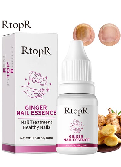 اشتري Ginger Nail Repair Liquid Treatment Essence Oil Nail Anti Remove Nail Onychomycosis Fungus Toe Nourishing Brighten Nail Care في الامارات