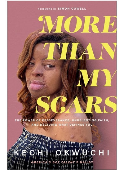 Buy More Than My Scars – The Power of Perseverance, Unrelenting Faith, and Deciding What Defines You in UAE