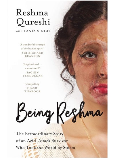 Buy Being Reshma: The Extraordinary Story of an Acid-Attack Survivor who Took the World by Storm in UAE