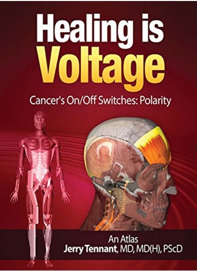 Buy Healing Is Voltage Cancers On/Off Switches Polarity by Tennant MD, Jerry L Paperback in UAE