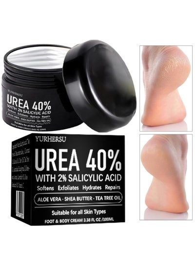 Buy 40% Urea Cream for Cracked Feet Hands 100ml Callus Remover Hand Cream Foot Cream for Cracked Foot Heels Elbows Nails Knees Skin Moisturizer Urea Lotion with Maximum Strength for Men and Women in UAE