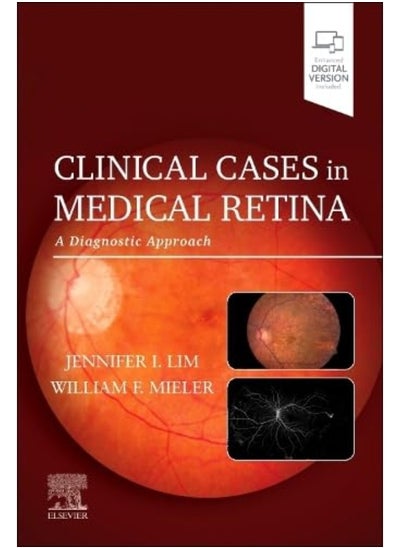 اشتري Clinical Cases In Medical Retina A Diagnostic Approach في الامارات