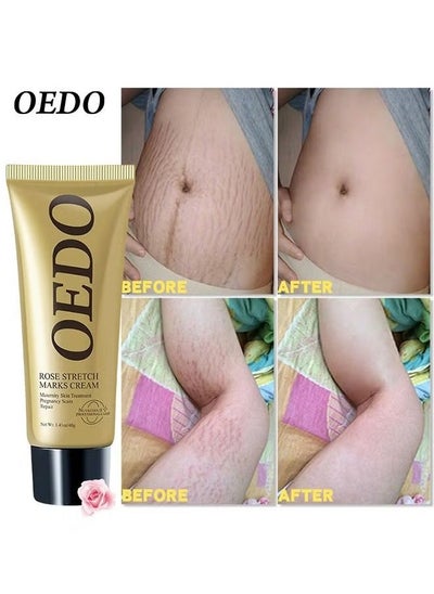 Buy Rose Stretchmarks Cream 40g Maternity Skin Treatment Pregnancy Scars Repair, Can Promote Cell Regeneration, Repair Necrotic Cells and Enhance Skin Elasticity, Designed For Mother's Stretch Marks in UAE